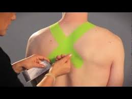 Pin On Kinesiotaping