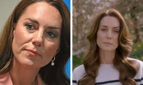 Cos'è la chemioterapia preventiva che sta facendo Kate Middleton e quali  sono gli effetti