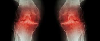 Protect your joints while housecleaning. Osteoarthritis Age How To Prevent And Treat Joint Pain Lbo