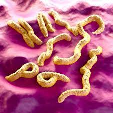 The world health organization (who) rates it as a risk group 4 pathogen. Marburg Virus Marv Ursachen Beschwerden Therapie Gesundpedia De