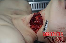 Autopsy of cute Chinese woman • GoreCenter