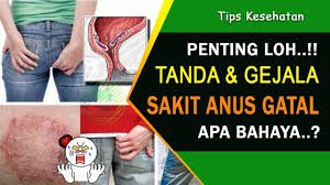 Botol kaca sepanjang 17 cm menembus dubur seorang pria karena keasyikan menggaruk punggungnya yang gatal. Mengapa Anus Saya Gatal 15 Penyebab Gatal Anal Gangguan Pencernaan 2021