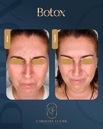 Caroline Fuchs‎‏ (@‏‎carol_fuchs‎‏) • صور ومقاطع فيديو على Instagram