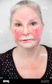 Flushed hi-res stock photography and images