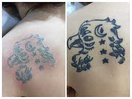 The luminette q tattoo removal machine. Tattoo Removal At Vada Spa After One Session Tattoo Removal Tattoos Ink Tattoo