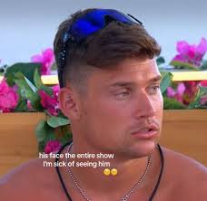 Ugly Photo of Aaron Love Island