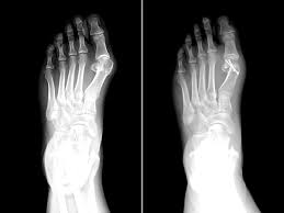 Op Dr Serdar Zengin Ortopedi Ve Travmatoloji Uzmani