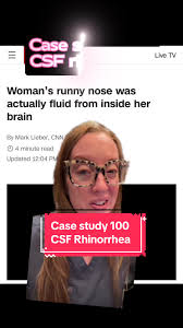 Image result for Cerebrospinal Fluid Color