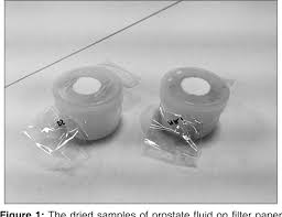 Image result for Expressed Prostatic Secretion