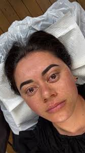 Imagine waking up every day with brows that are already shaped, defined,  and ready to go… no pencils, no powders, just perfect brows. That’s the  magic of Ombré Brows!, This soft-shaded technique gives ...