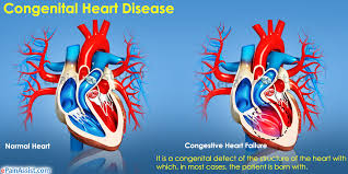 Human Biology Online Lab Congenital Heart Disease By Farhiya Abdi Download these biology background or photos and you can use them for many purposes, such as banner, wallpaper, poster background as well as powerpoint background and website background. congenital heart disease by