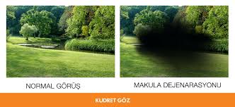 Fotograftaki Gibi Bir Goruse Sahipseniz Makula Dejenarasyonu Rahatsizliginiz Olabilir Ve Cok Gecmeden Mutlaka Bir Doktora Danismaniz Fotograf Doktorlar Pitaya