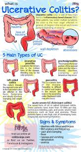 Pin On Medical Conditions