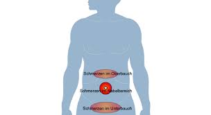 Akutes Abdomen