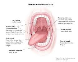 Image result for spinocellular carcinoma of the oral cavity