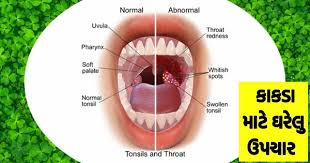 Your health and safety at work in agriculture and . Kakda In Neck Tonsils Gharelu Upchar Health Tips In Gujarati
