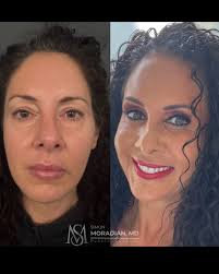 Join us in congratulating Dr. Neil Fine