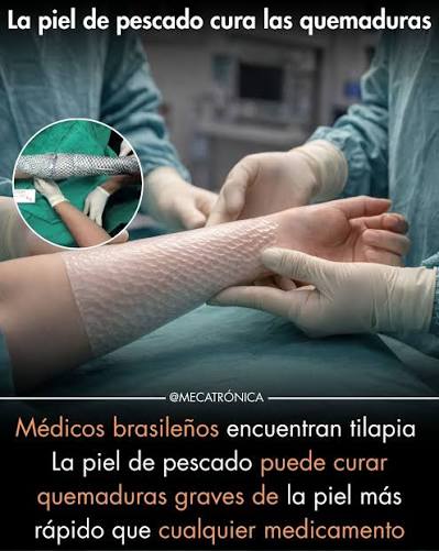 Brasil ha investigado el uso de piel de tilapia como apósito biológico para  tratar quemaduras. La piel de tilapia contiene colágeno y propiedades  estructurales que pueden ayudar a proteger heridas y favorecer