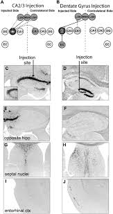 Image result for Black 1997 AAV