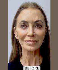 Gallery of Procedures