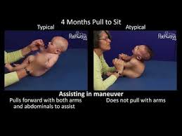 4 Month Old Baby Typical Atypical Development Side By Side