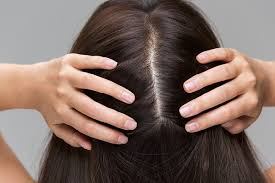 Use a measuring spoon to ensure that you get the right amount. Witch Hazel For Hair Benefits What Is It And How To Use Be Beautiful India