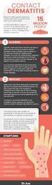 Image result for Contact Dermatitis