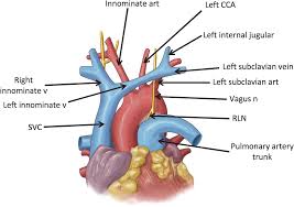 Decreased number of superior mediastinal disease found at. Thoracic Vessels Chapter 16 Atlas Of Surgical Techniques In Trauma