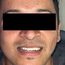 Marlon Bravo (@marlonbravo_odontologiadigital) • Instagram photos and videos