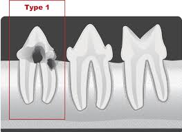 Avdc Nomenclature Avdc Org