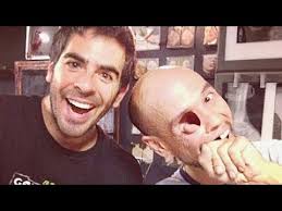 Billy owen)shocking story of billy owen #HYIndian