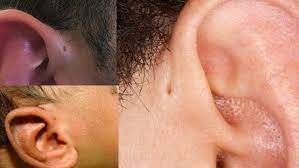 Codycross trous naturels comme les narines ou les oreilles, nous. Qu Est Ce Donc Ce Petit Trou Inutile Qu On A Sur L Oreille