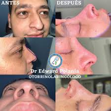 Dr Edward Polanía Jácome (@dr_edwardpolania) • Instagram photos and videos