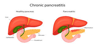 Image result for pancreas)