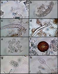 Image result for Protozoa