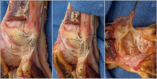 Image result for TFCC Steroid Injection