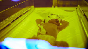 Cara mengetahui kadar bilirubin bayi baru lahir adalah dengan. Penyebab Bayi Kuning Dan Cara Mengatasinya Orangtua Perlu Tahu Hot Liputan6 Com