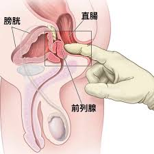 前列腺高潮怎麼爽？5 步解鎖男G點+第一次完整體驗指南- loveme悅己情趣