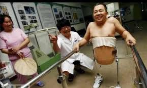 En 1995, Peng Shuilin, un comerciante chino, sufrió un accidente de tráfico  tan brutal que le destruyó por completo la mitad inferior del cuerpo. Los  médicos apenas le daban horas de vida,