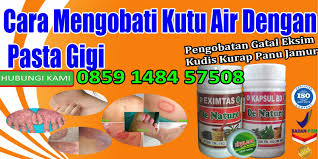Cara Mengobati Kutu Air Dengan Pasta Gigi