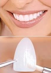 In 2021, bcbs's most popular ma plans include low primary care visit copayments and $0 again, most bcbs medicare advantage health plans offer dental, vision, and hearing coverage. Cover Blemished Teeth With Veneers Lumineers Bayonne Nj Doria Dental