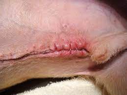 This can lead to a fatal infection. Surgical Site Infection