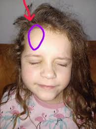 Do you get a dent in your forehead from playing games?