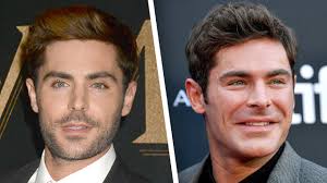 Hatte Zac Efron eine Gesichts-OP? So sah er früher aus