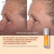 Super Vitamin C Total Facial Serum 1 oz bottle