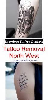 How To Remove Permanent Tattoo From Skin At Home Blue Tattoo Removal How Remove Tattoo In Hindi Tatto Tattoo Removal Tattoo Removal Cost Diy Tattoo Permanent