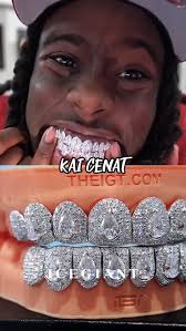 Lebron James Teeth Accessories & Fashion Statements, timeless piece with  this custom Grillz, 🥶 Diamond Bridge Grillz with custom-cut marquise  style. 🔥 Join us for a similar custom, 🙌 you will instantly