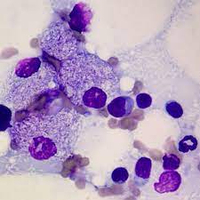 Mycobacterium In Lymph Node Of A Cat On Immunosuppressants Vet Clinics Veterinary Veterinary Technician