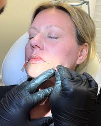 Nabi Medical Aesthetics, 431 N Washington Ave, Scranton, PA 18503, US