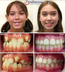 TenBrook Orthodontics（@tenbrookortho）• Instagram 相片與影片